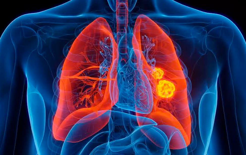 Ilustración de sistema pulmonar